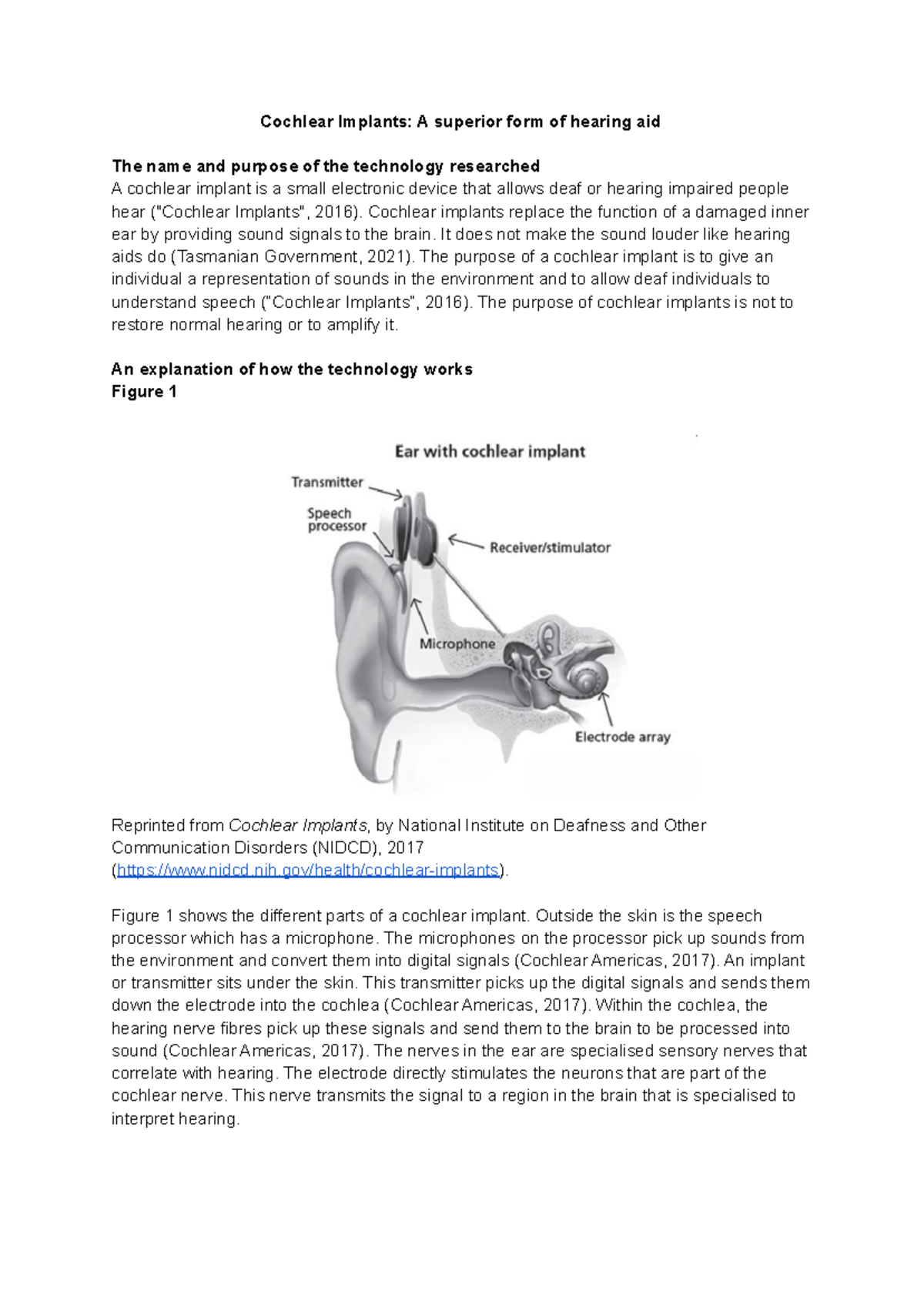 Scientific report - Cochlear Implants: A superior form of hearing aid ...