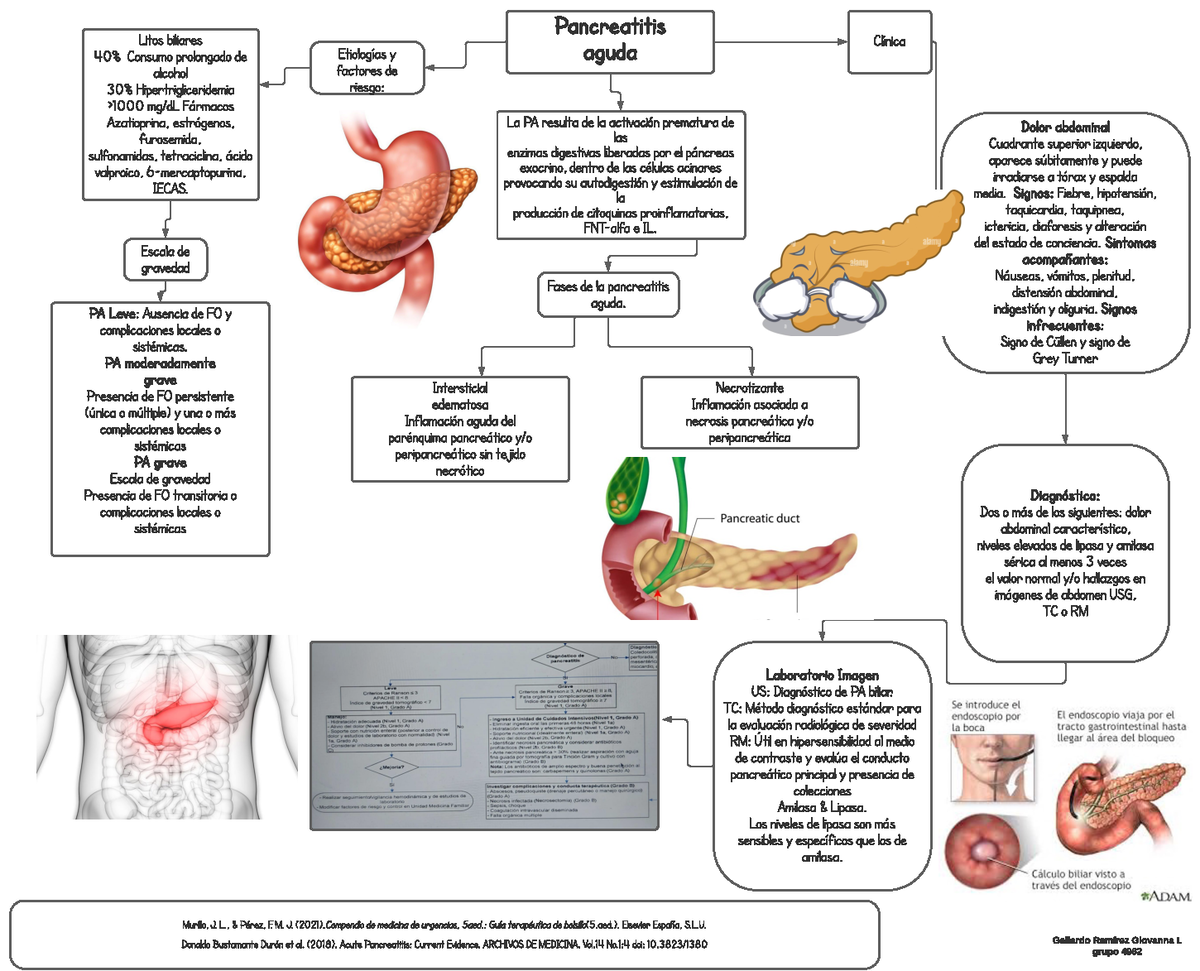 Pancreatitis Aguda Urgencias Gallardo Ramírez Giovanna I grupo 4962