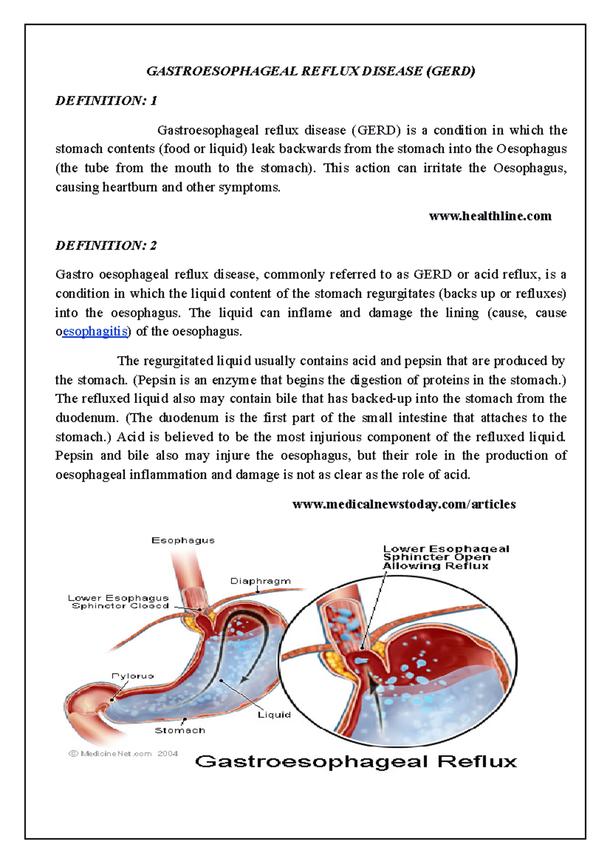 18. GERD - DISEASE CONDITION ON GERD - GASTROESOPHAGEAL REFLUX DISEASE ...