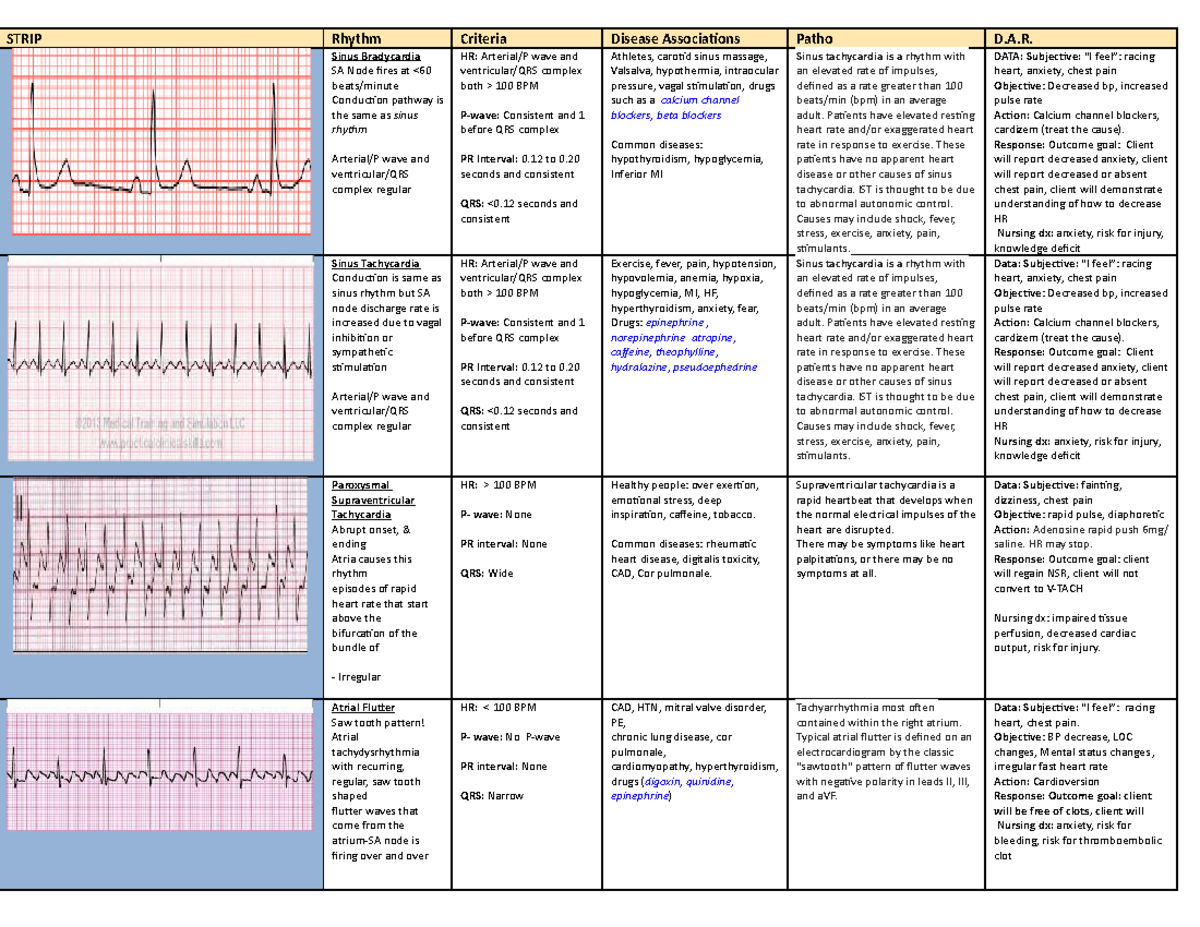 EKG chart - Lecture notes Lecture notes - STRIP Rhythm Criteria Disease ...