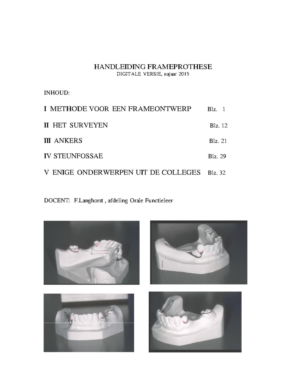 Samenvatting Partiele Prothese - HANDLEIDING FRAMEPROTHESE DIGITALE ...