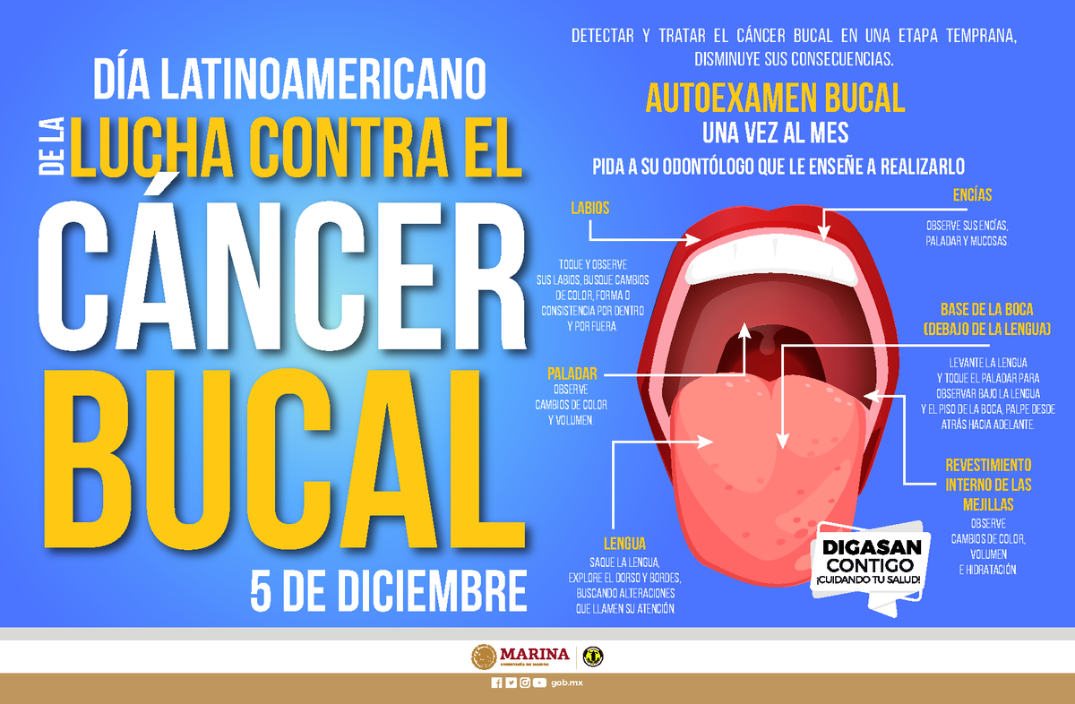 Cancer Bucal 2023 Resumen Salud Punblica Lucha Contra El Día Latinoamericano Cáncer Bucal 5 