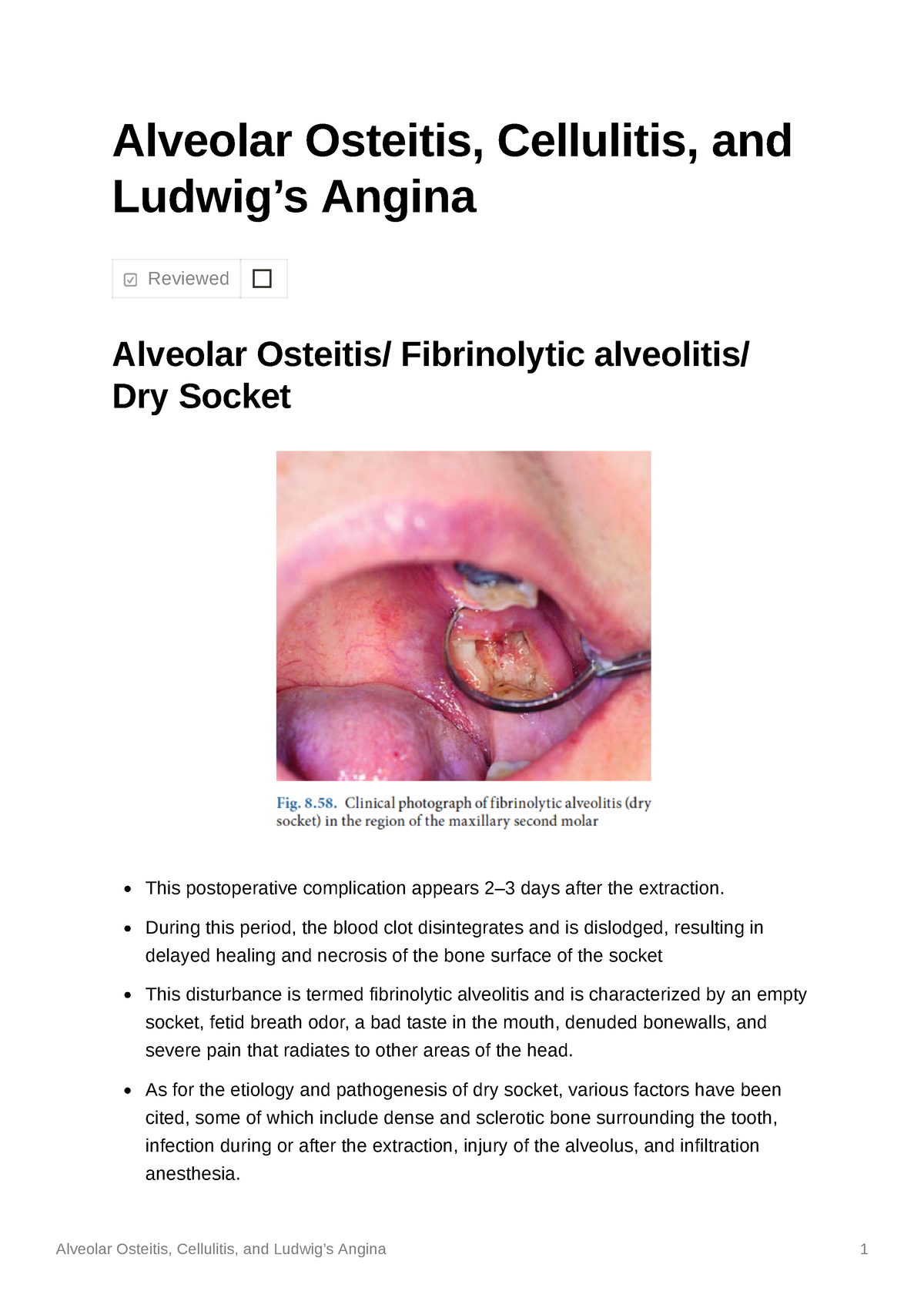 Alveolar Osteitis Cellulitis And Ludwigs Angina Alveolar Osteitis Cellulitis And Ludwigs 1506