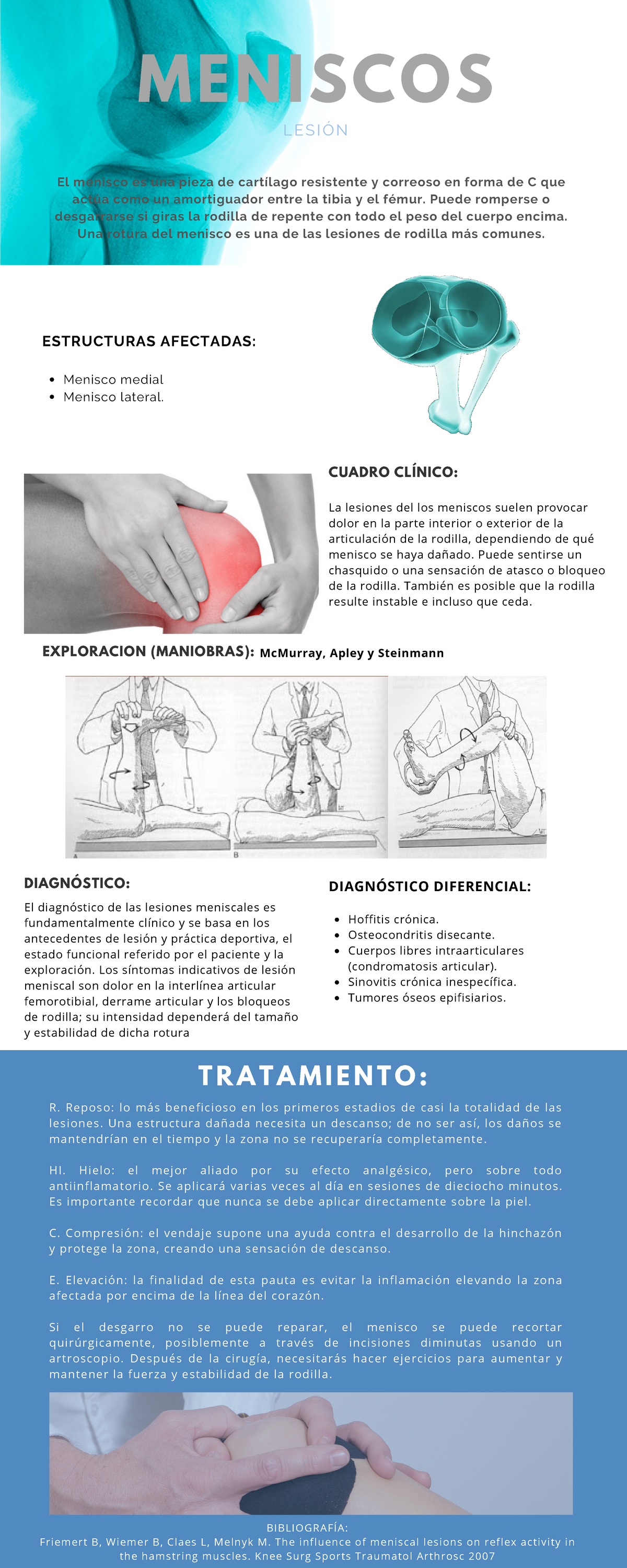 Infografi Alesio Ndemeniscos Reposo Lo Beneficioso En Los Primeros Estadios De Casi La Totalidad De Las Lesiones Una Estructura Da Ada Necesita Un Descanso Studocu