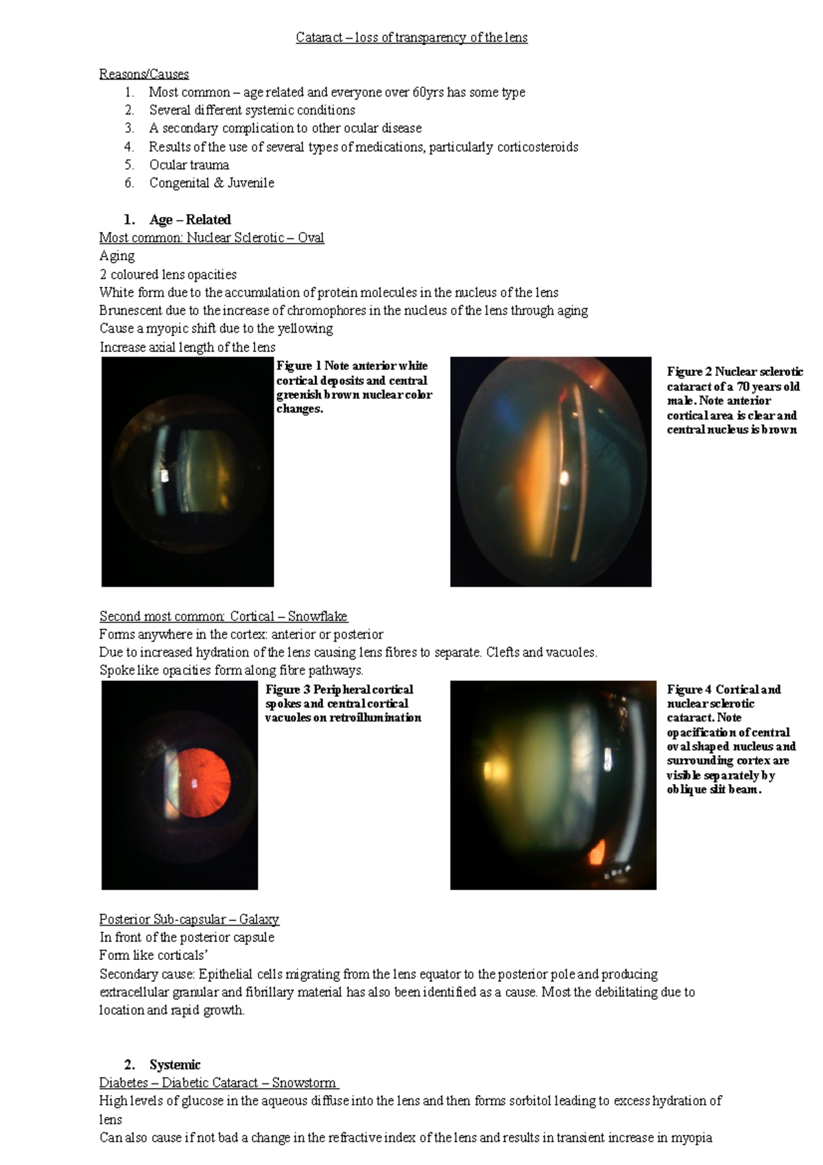 Cataracts Formation and Surgical Complications Cataract loss of