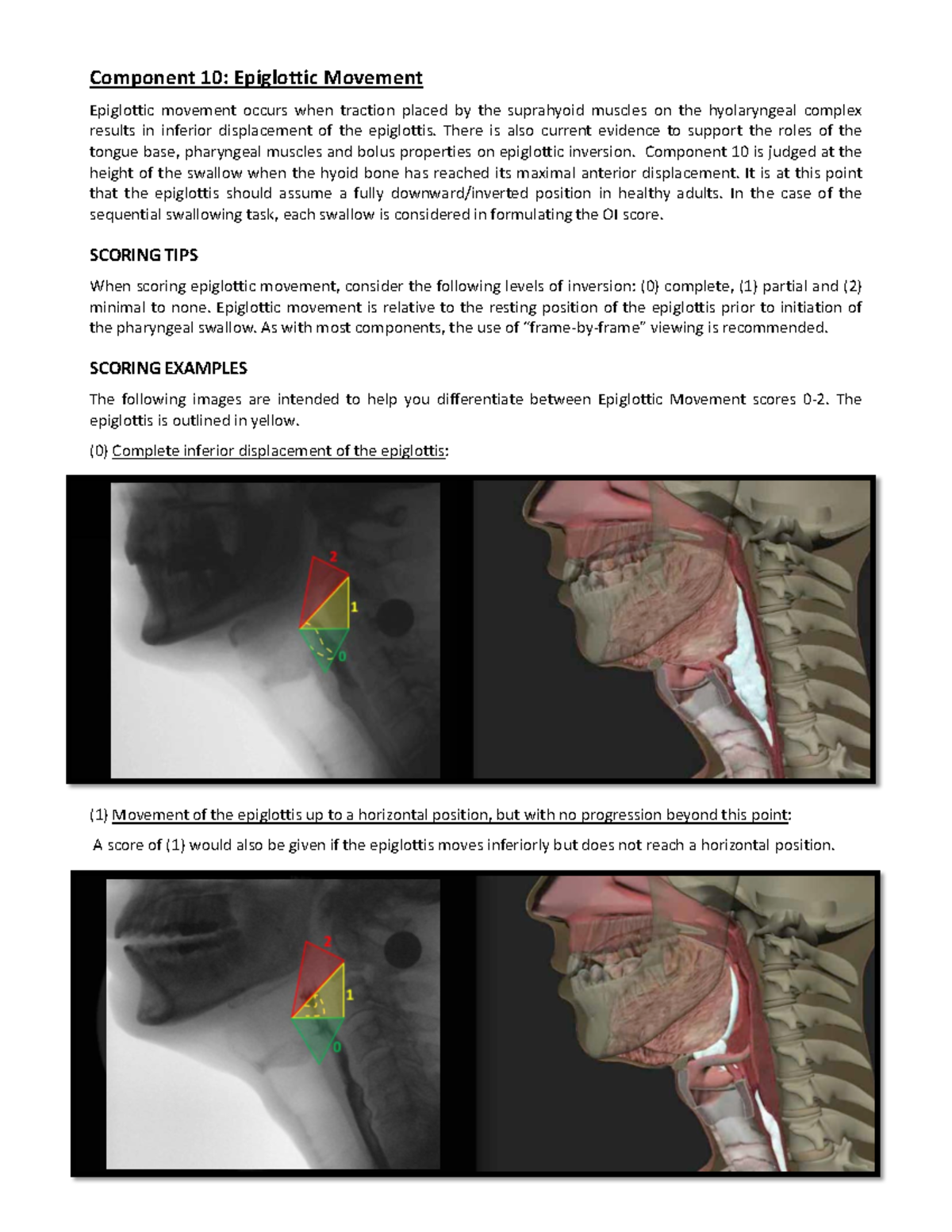 10Scoring Tips PDF - Swallow study practice - Component 10: Epiglottic ...