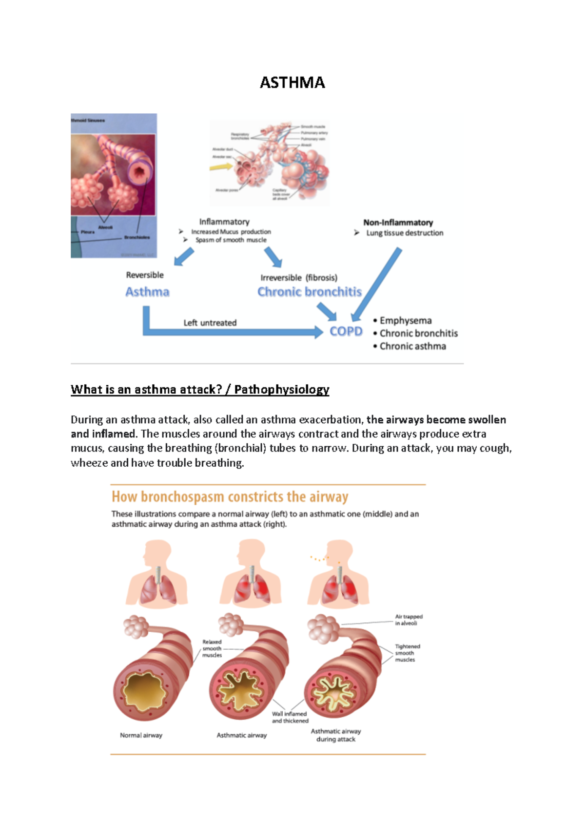 Meds and Respiratory ASTHMA What is an asthma attack