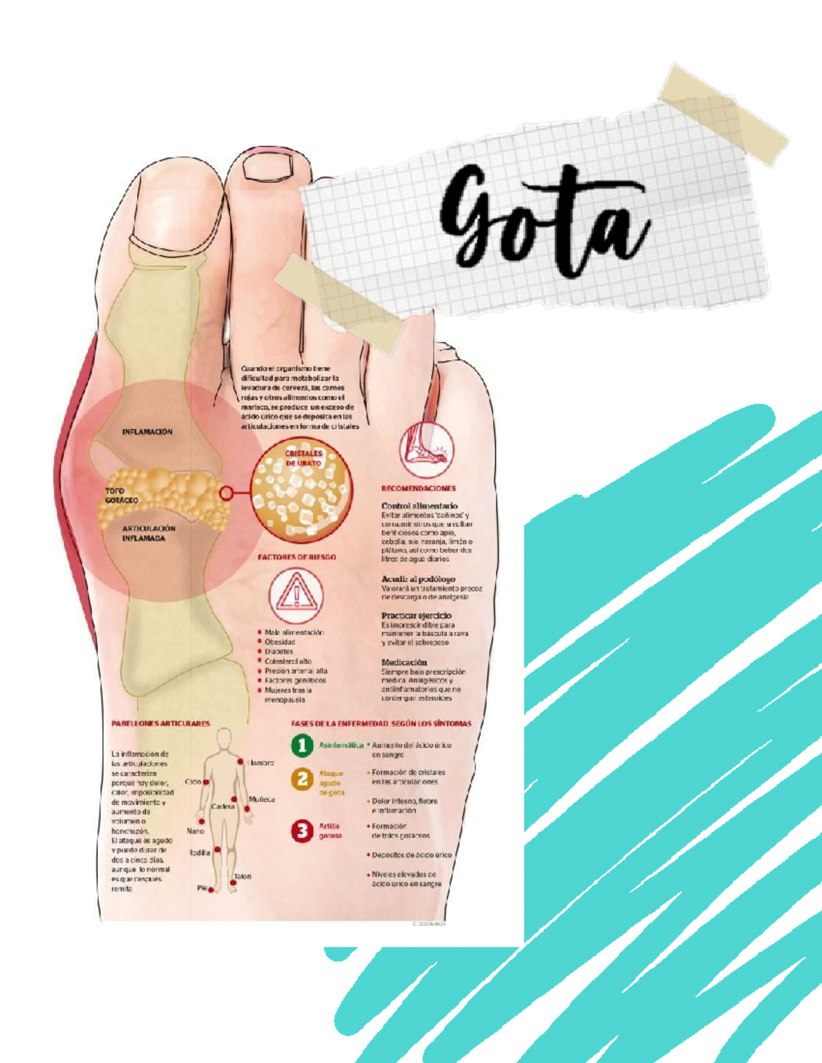 GOTA Investigación sobre la enfermedad de la gota ENFERMEDAD Studocu