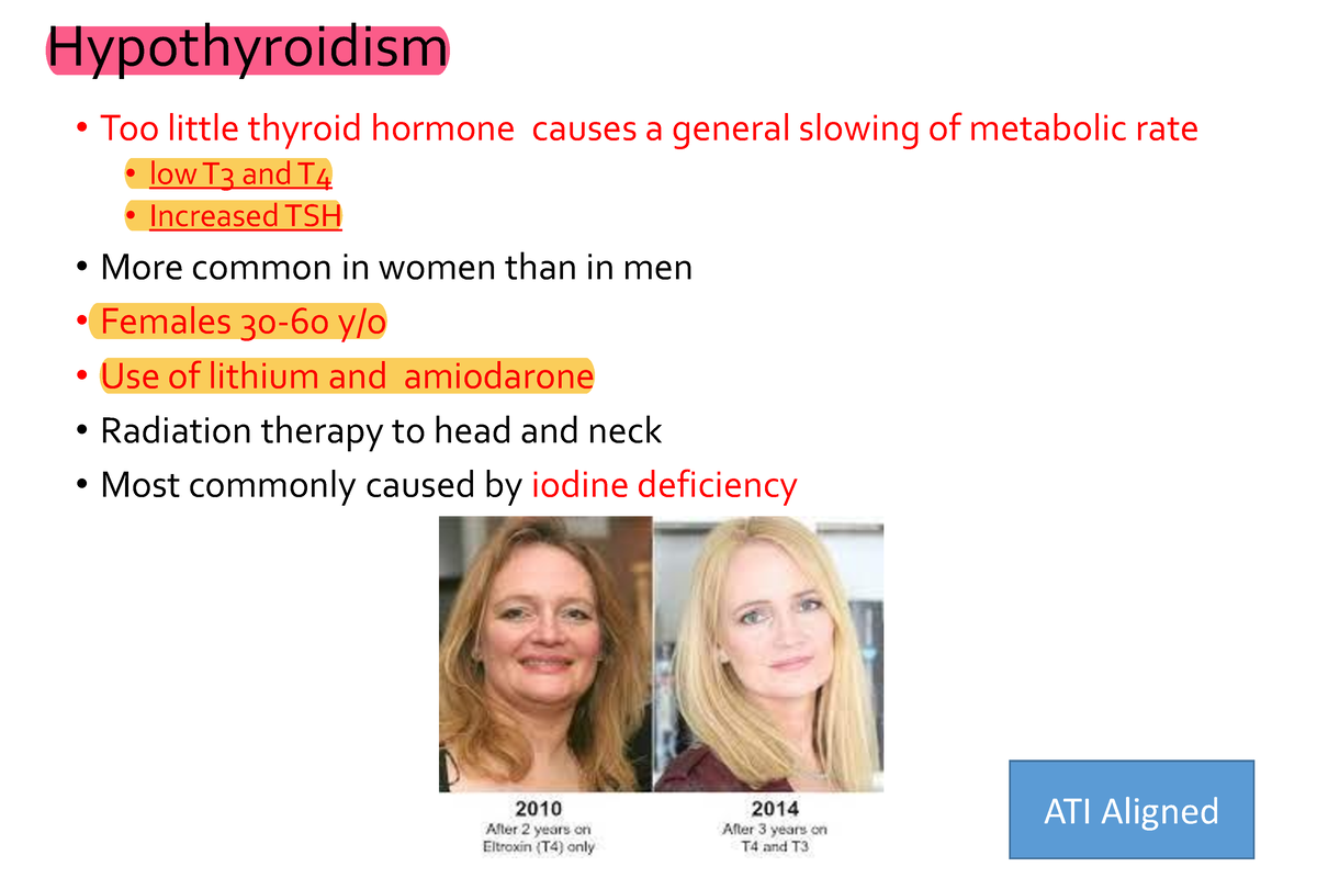 Week 6 Hypothyroid Mia - Practice Material - Hypothyroidism • Too ...