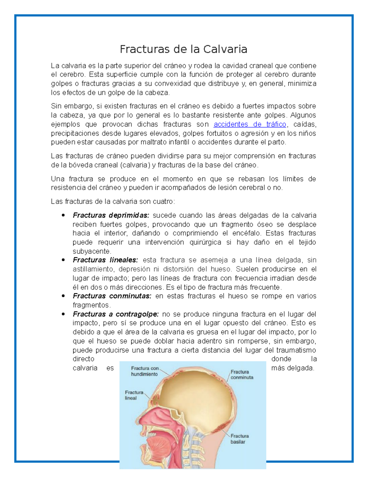 Lesión cerebral fractura de cráneo basilar