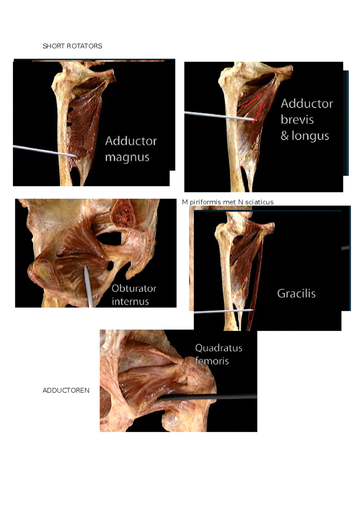 Dissectie heup - pretest - Locomotorisch stelsel en huid - SHORT ...