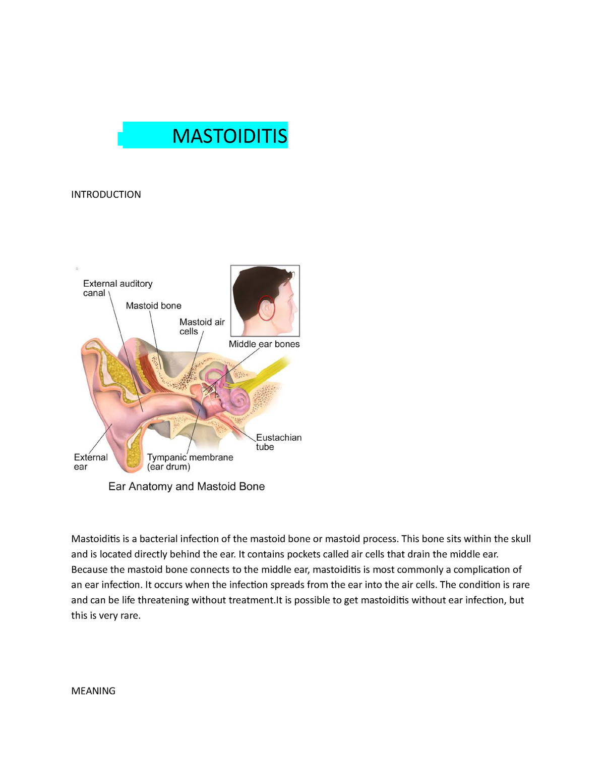 Mastoiditis Is-WPS Office - Bsc.nursing - RGUHS - StuDocu