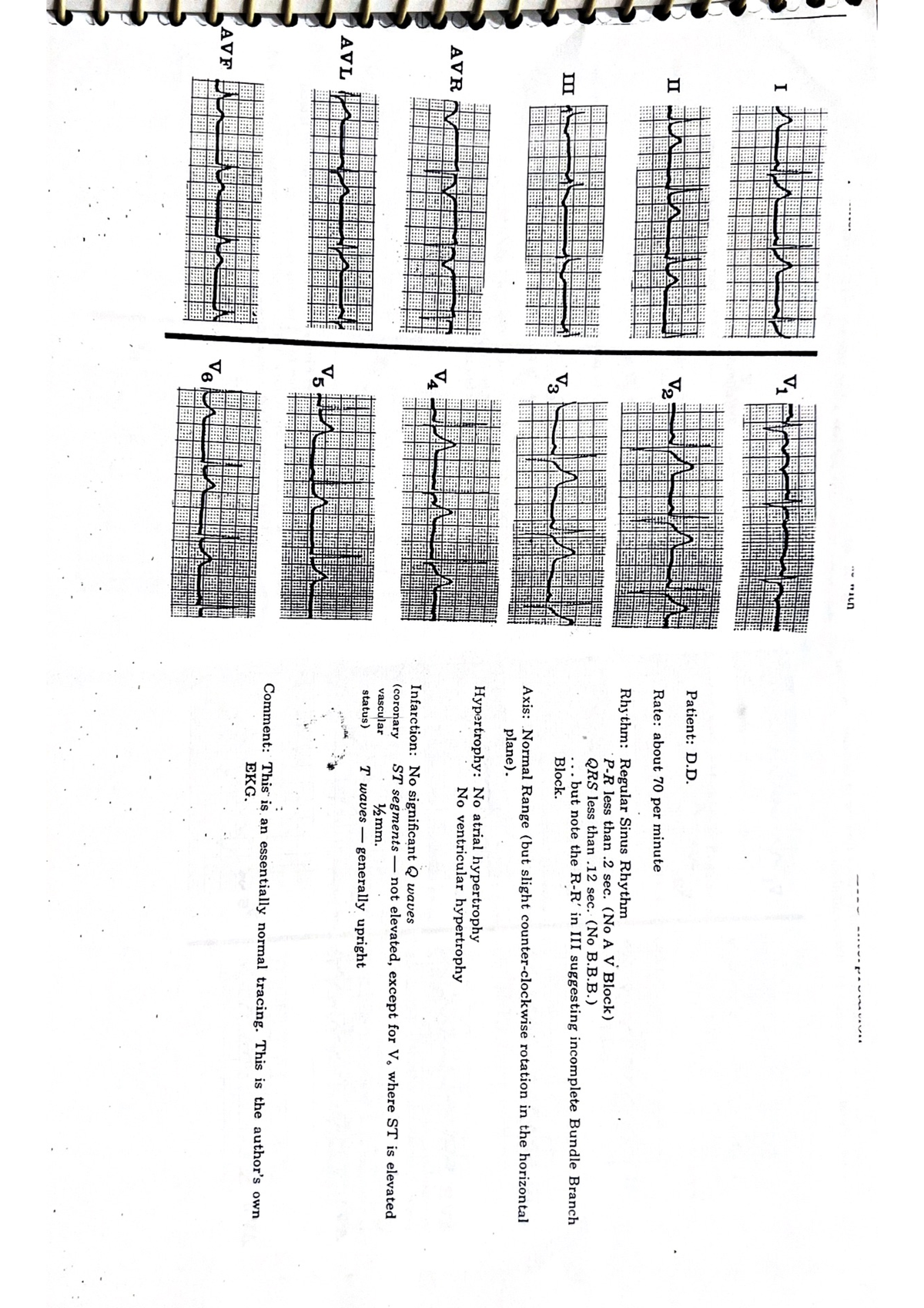 ecg-rates-ecg-rate-of-heart-bachelor-of-pharmacy-studocu