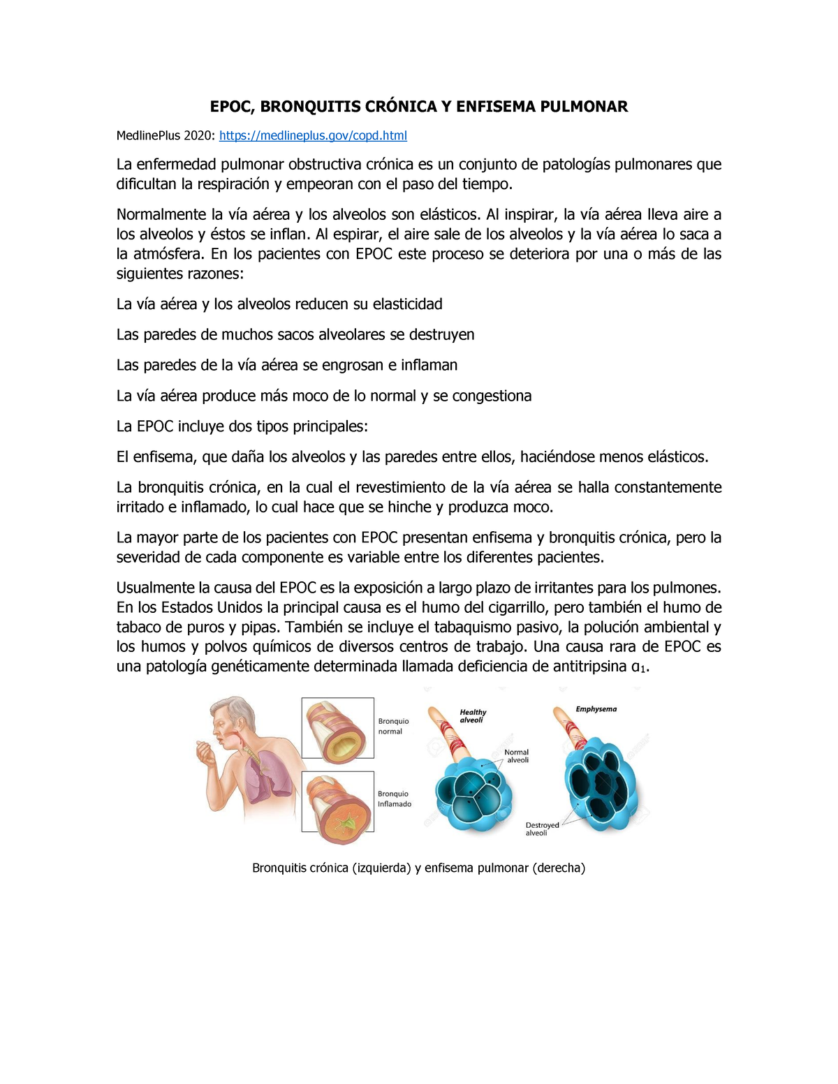 Epoc Bronquitis Crónica Y Enfisema Pulmonar Epoc Bronquitis CrÓnica