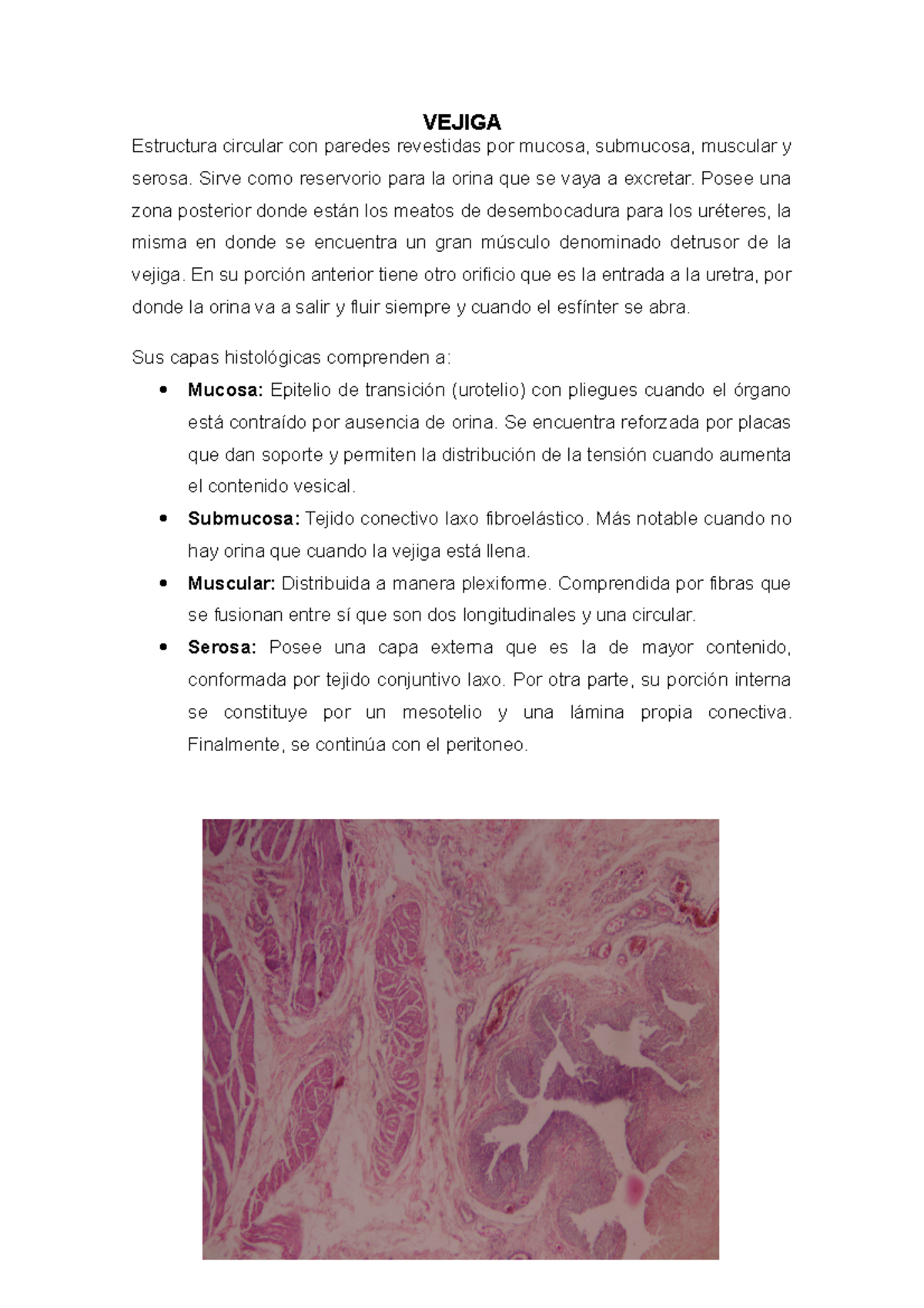 histología de la vejiga