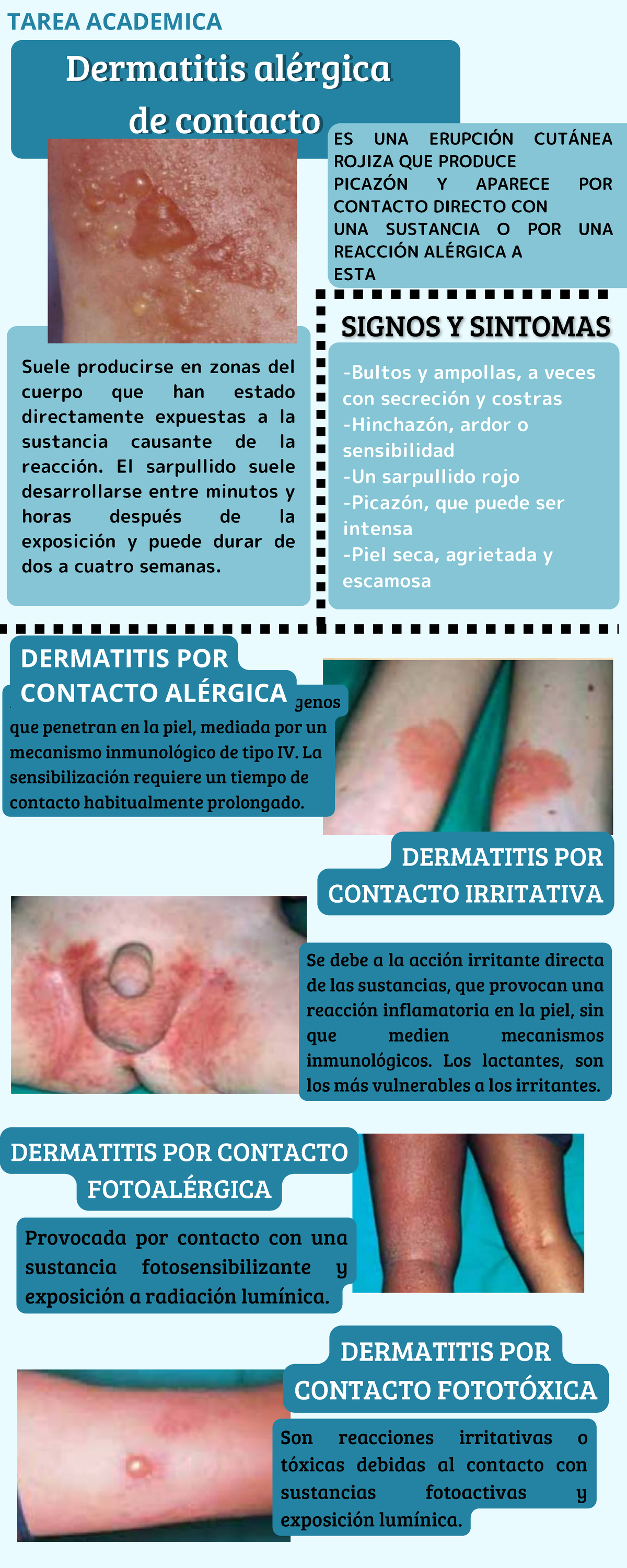 mecanismo de la dermatitis alérgica de contacto