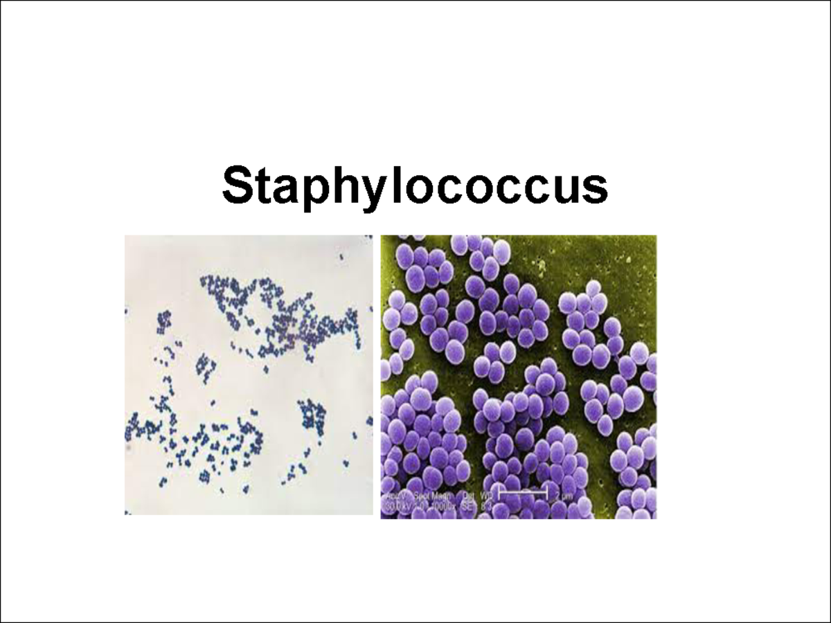 Staphylococcus - microbiology notes - Staphylococcus Staphylococci ...