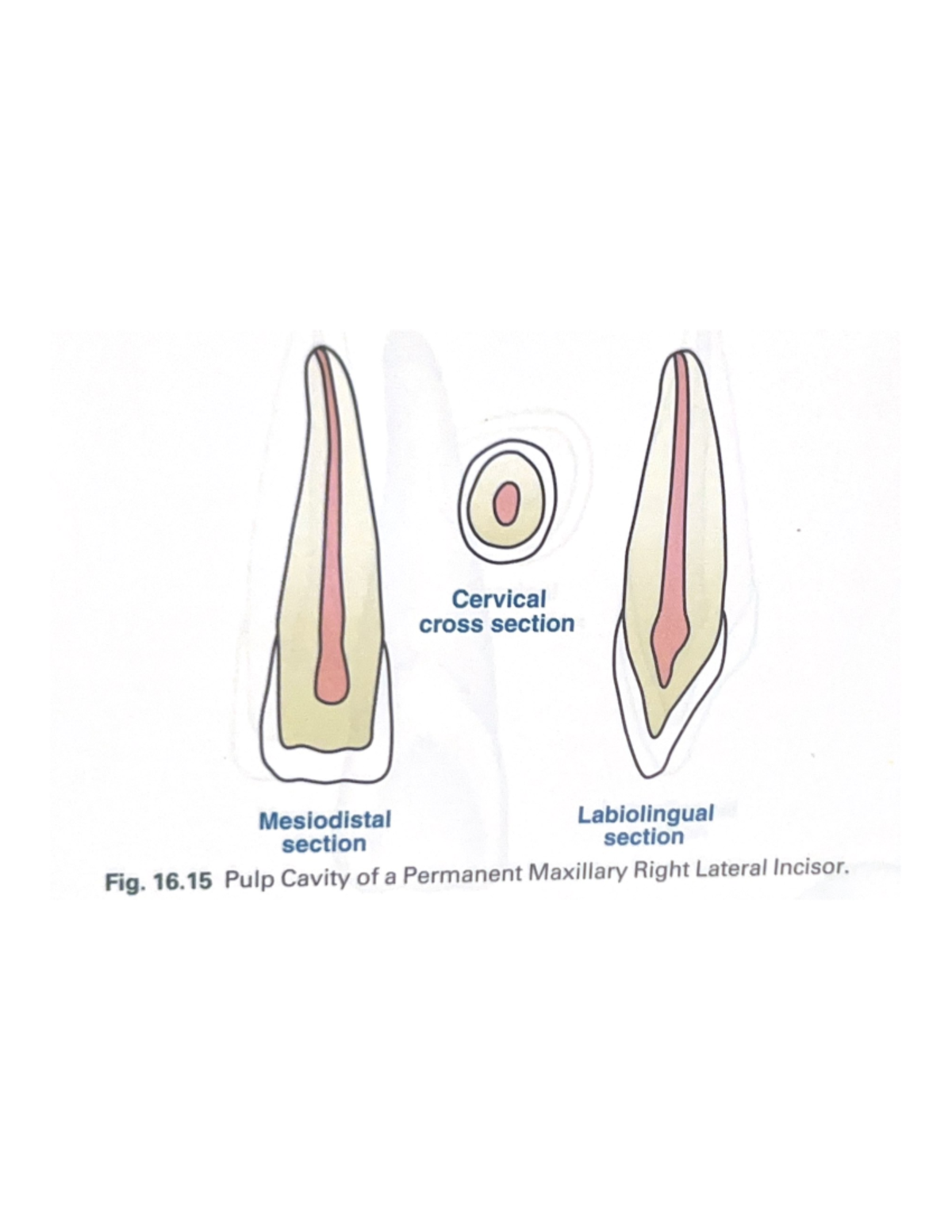 Teeth 1 test 2 - None - CDM 260 - 0 Cervical cross section Mesiodistal ...