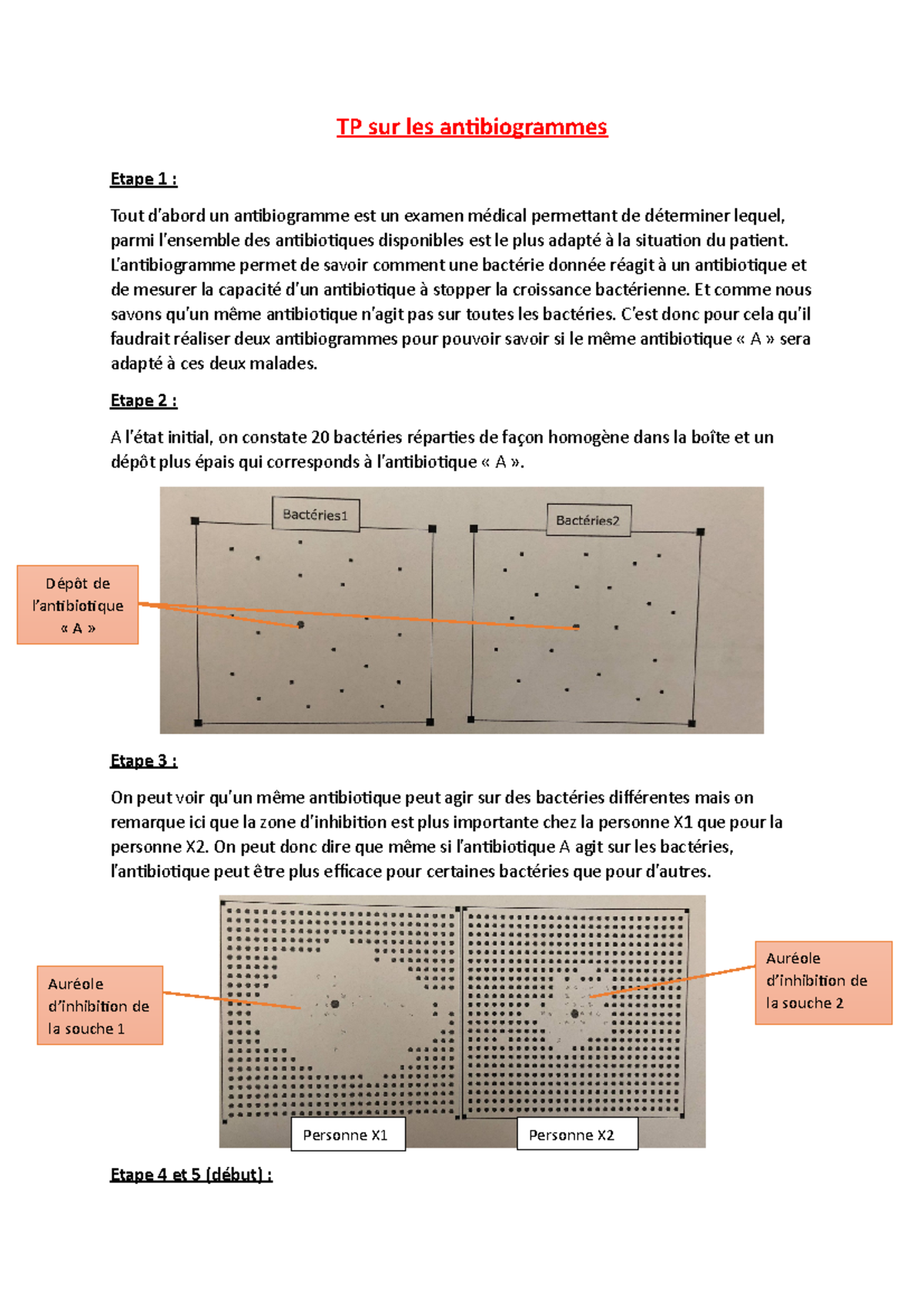 C’Est Quoi Un Antibiogramme: Résultats Antibiogramme – LVZPMQ