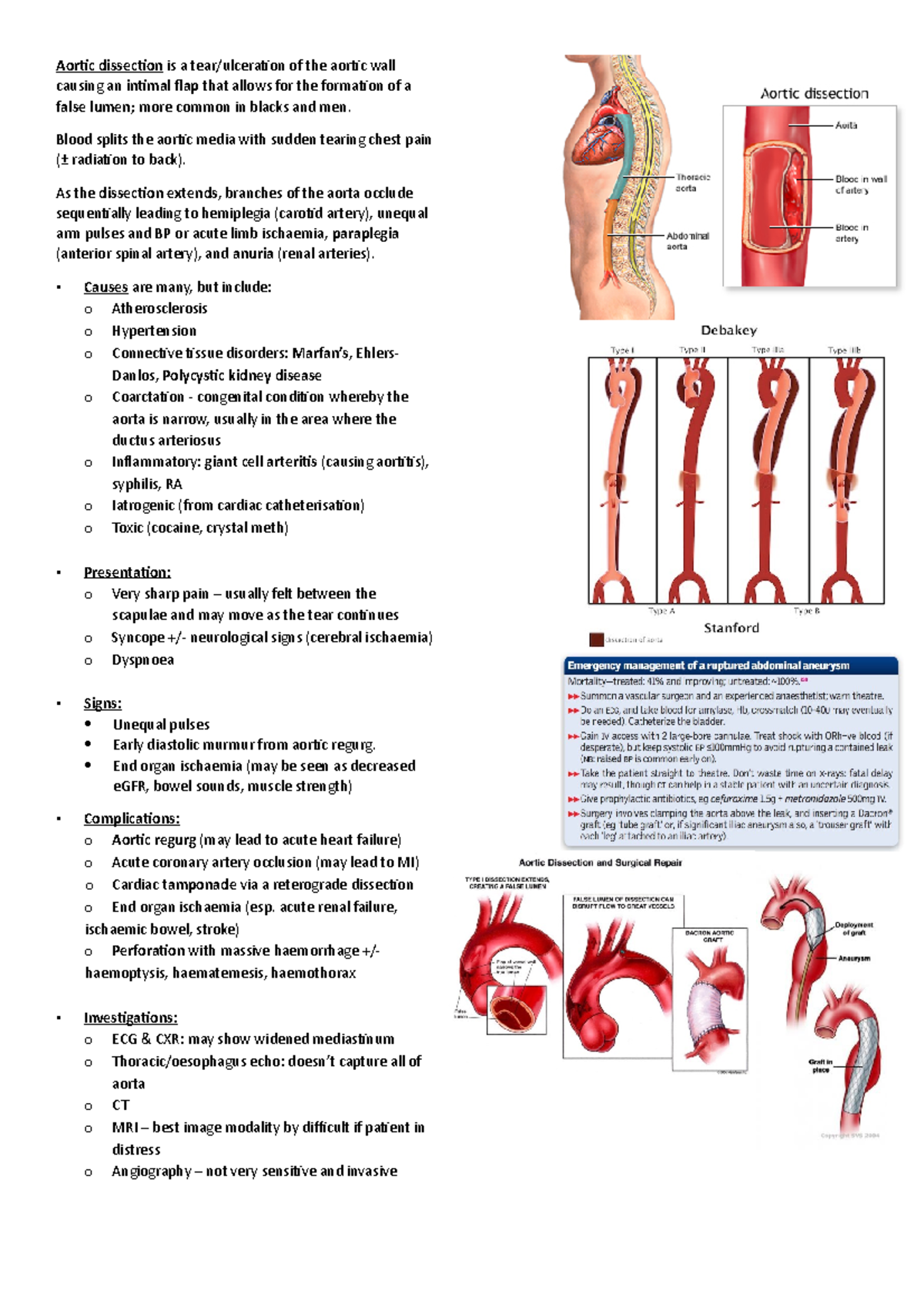 Aortic dissection - Summary notes - Aortic dissection is a tear ...