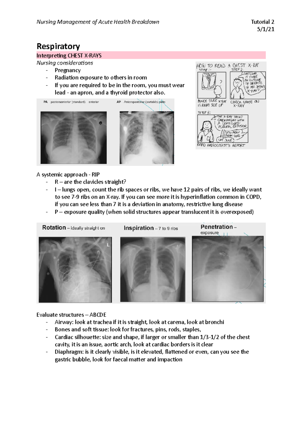 Tutorial 2 - 5/1/ Respiratory Interpreting CHEST X-RAYS Nursing ...