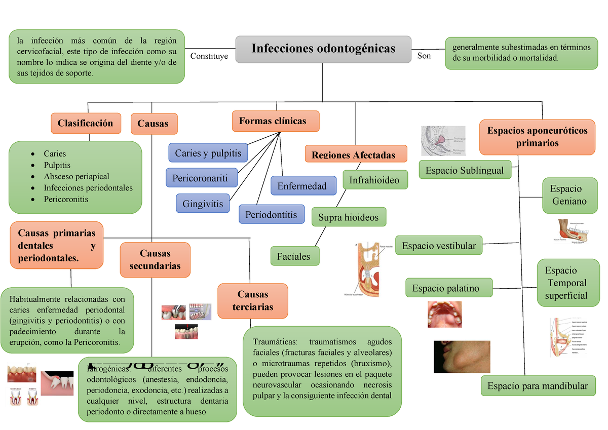 Mapa Conceptual Infecciones Odontog Nicas Infecciones Odontog Nicas La Infecci N M S Com N De