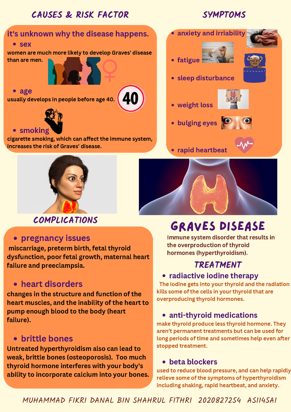 Graves disease anxiety and irriability fatigue sleep disturbance weight loss bulging eyes