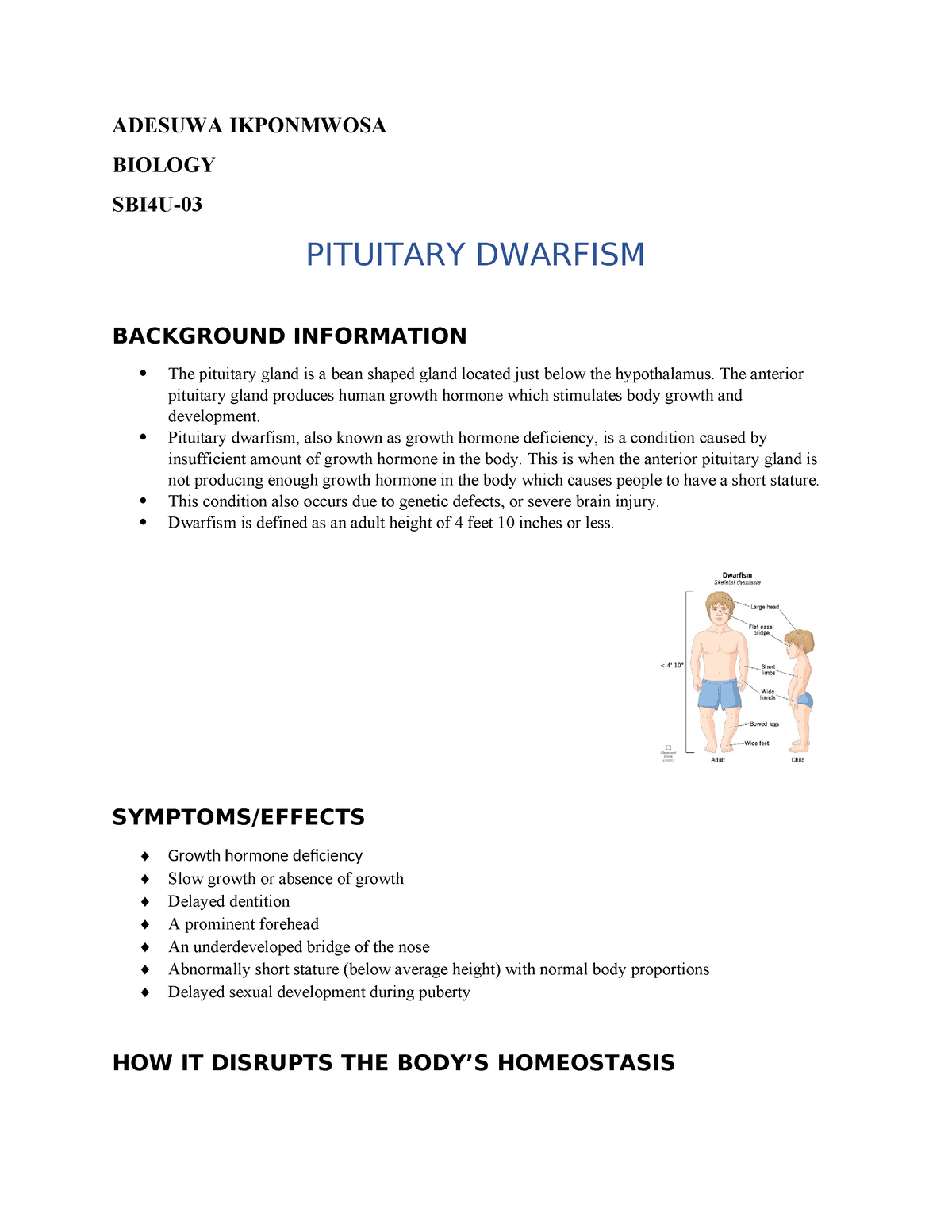 Dwarfism (Skeletal Dysplasia) & Other Causes of Short Stature