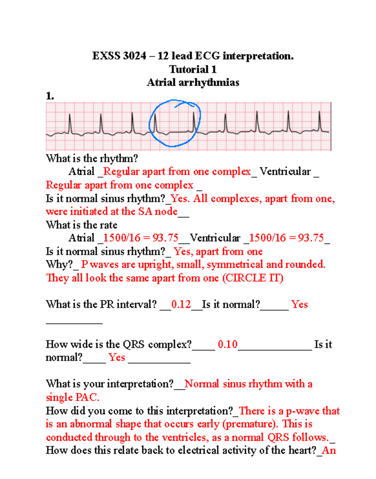 Exss 3024 12 Lead Interpretation Tutorial 1 Answers Exss 3024 12