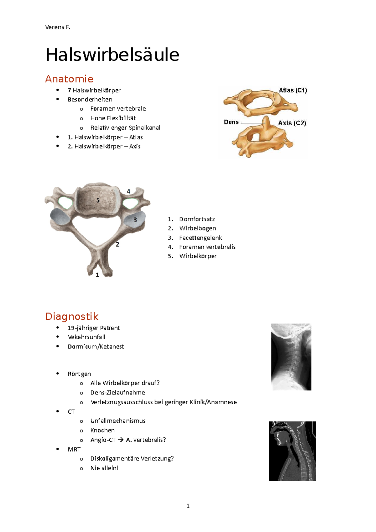 Chirurgie Halswirbelsäule - Halswirbelsäule Anatomie 7 Halswirbelkörper ...