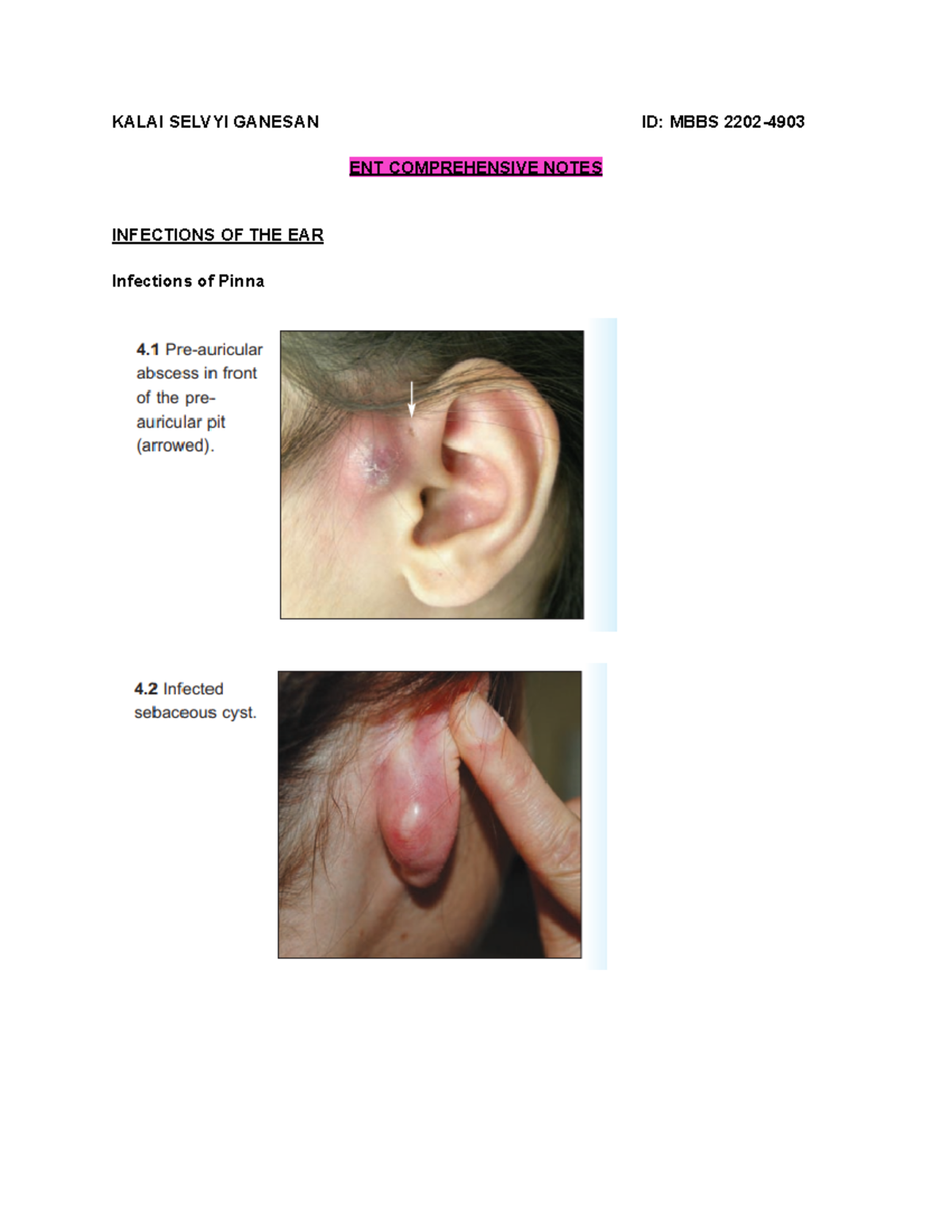 ENT Notes Kalai - Summary Surgery I - KALAI SELVYI GANESAN ID: MBBS ...