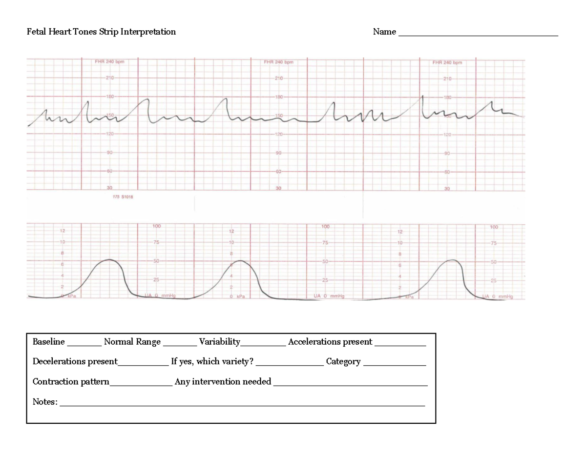 Student-Fetal+Heart+Tones+Strip+Interpretation - Fetal Heart Tones ...