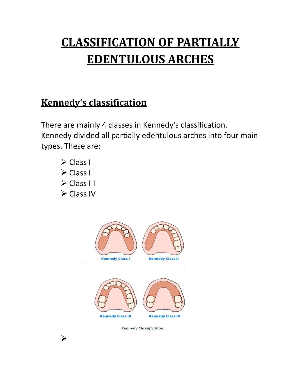 Kennedys classification Kennedy divided all partially edentulous