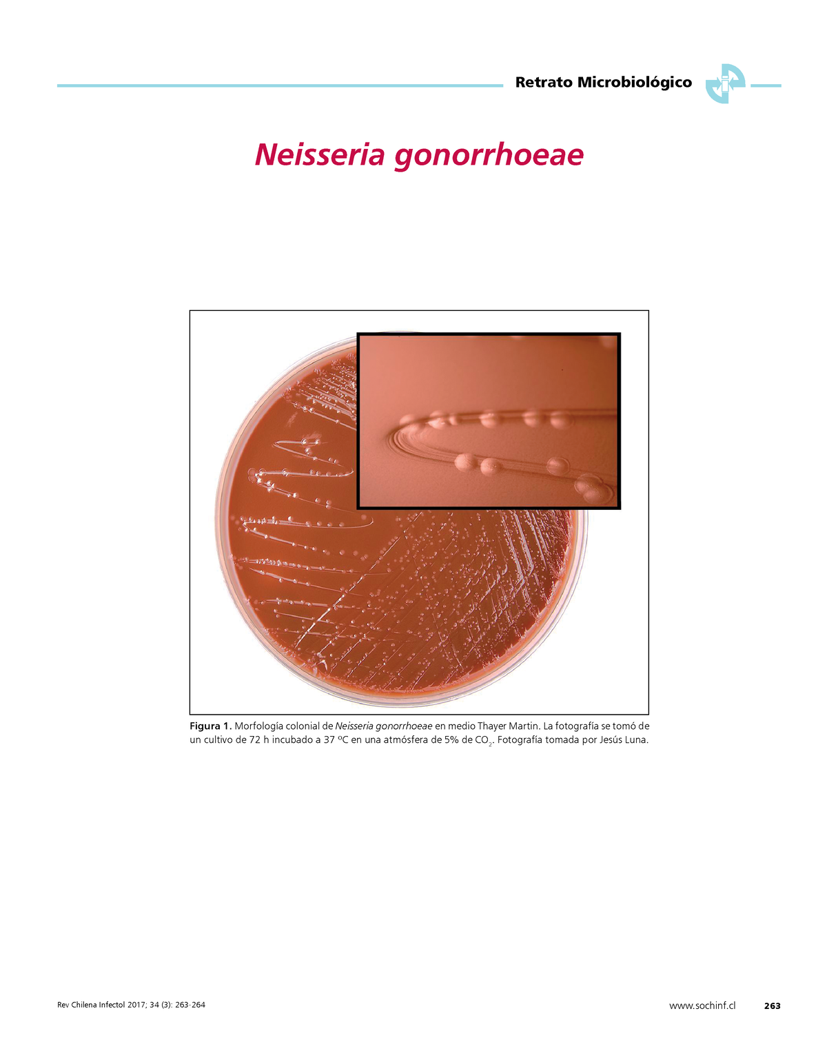 Pdf Gonorrea Sochinf 263 Retrato Microbiológico Neisseria Gonorrhoeae Figura 1 Morfología 1272