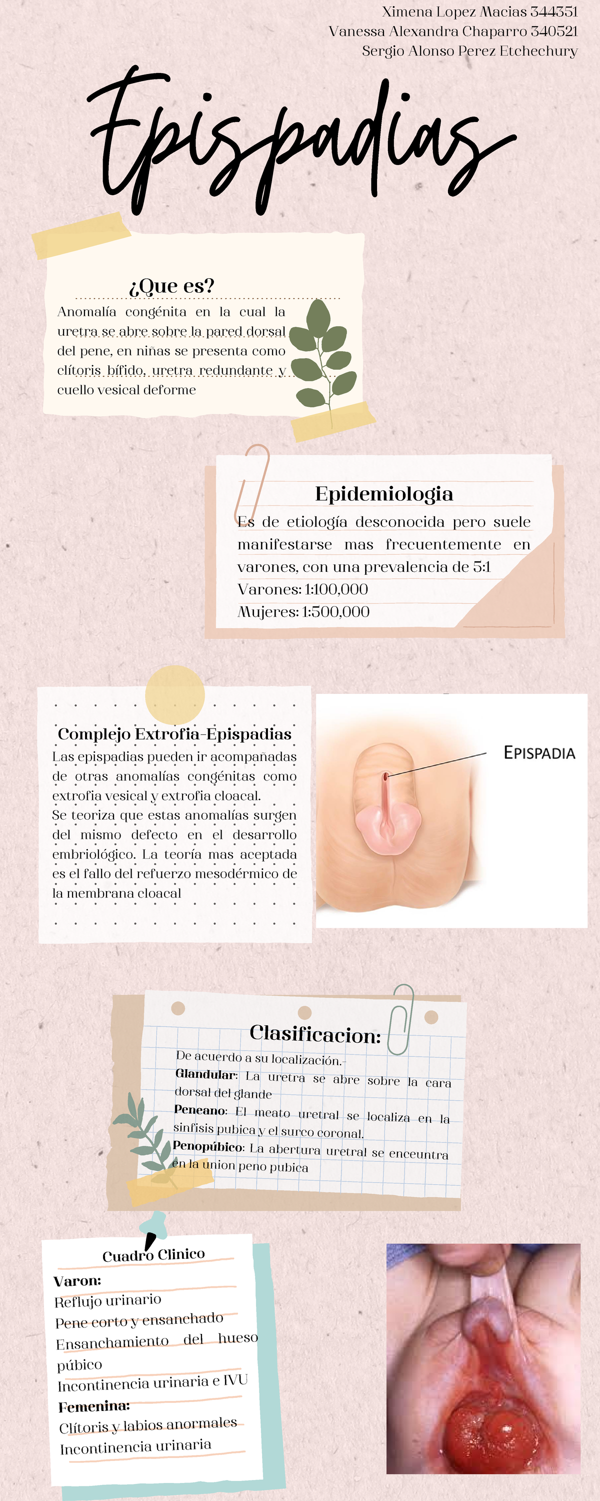 Epispadias Info - infografia del resumen delresumen de espispadias ...