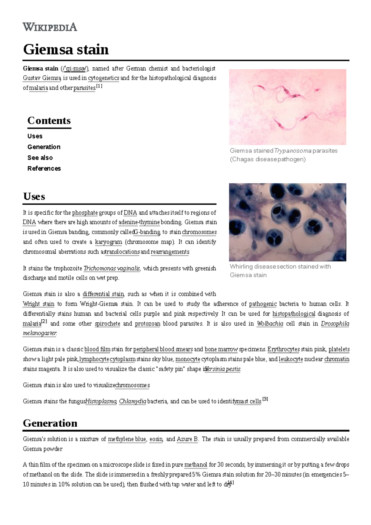 Giemsa stain - asdcvbbb - Giemsa stain Giemsa stain (/ˈɡiːmsə/), named ...