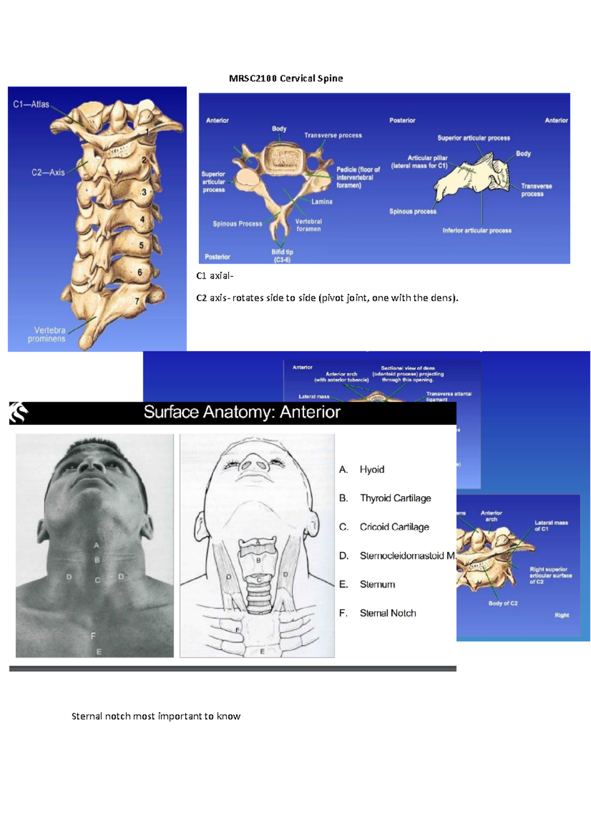 MRSC2100 Lecture 1 Cervical spine Notes - MRSC2100 Cervical Spine C1 ...