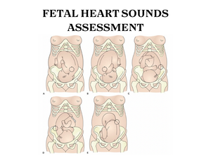 ECG Uworld Questions - ECG UWORLD DRILLS The nurse is monitoring a ...