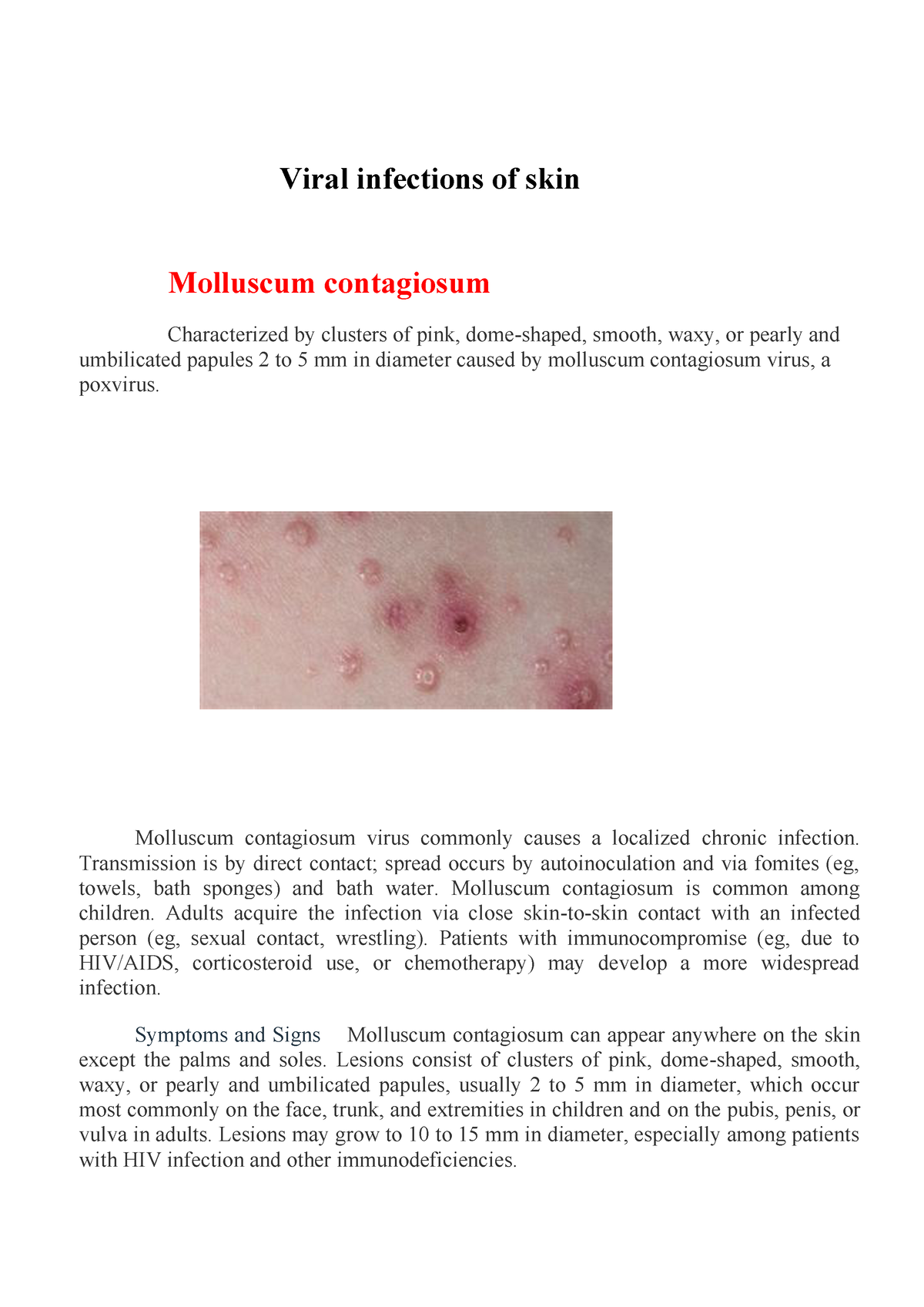 Viral Infections Of Skin Viral Infections Of Skin Molluscum Contagiosum Characterized By 