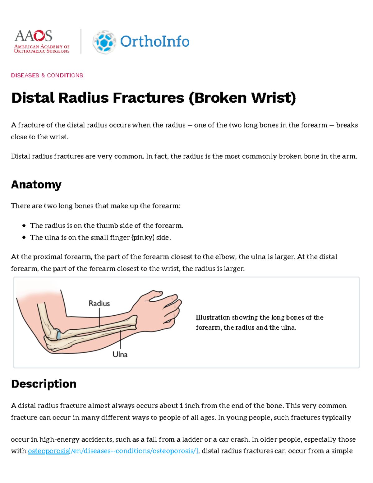 Distal Radius Fractures (Broken Wrist) - now - DISEASES & CONDITIONS ...